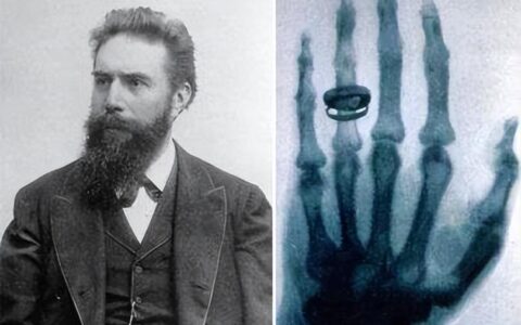 X射线技术的发展历程-x射线成像技术的发展历史简述