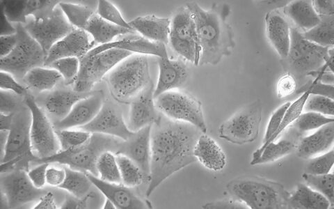 韩国食物中毒事件背后的深层原因：一场与病原体的较量