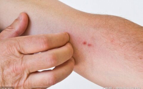 春季皮肤为何容易过敏？做好这些措施，放心去春游