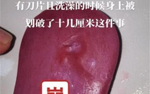 一个月内第二起？网友自称洗澡时被舒肤佳香皂内刀片划伤，品牌方回应