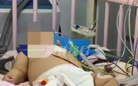 女婴心脏惊现绣花针，父母称不知情，医生推断引热议