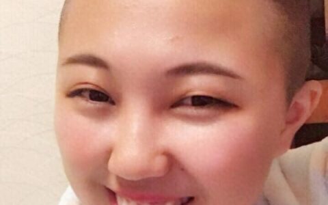 武汉女生剃光头蓄发5个月：新发炸毛似“海胆”引发热议-女生剃成光头