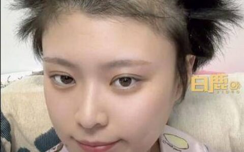 女生剃光头蓄发5个月炸毛似海胆-女士剃光头