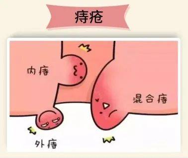【广州建康医院是正规的】护菊小贴士｜肛肠问题知多少？-广州建康医院简介